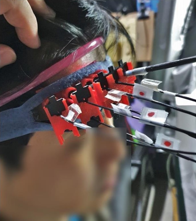 Optical fiber probes placed on the forehead